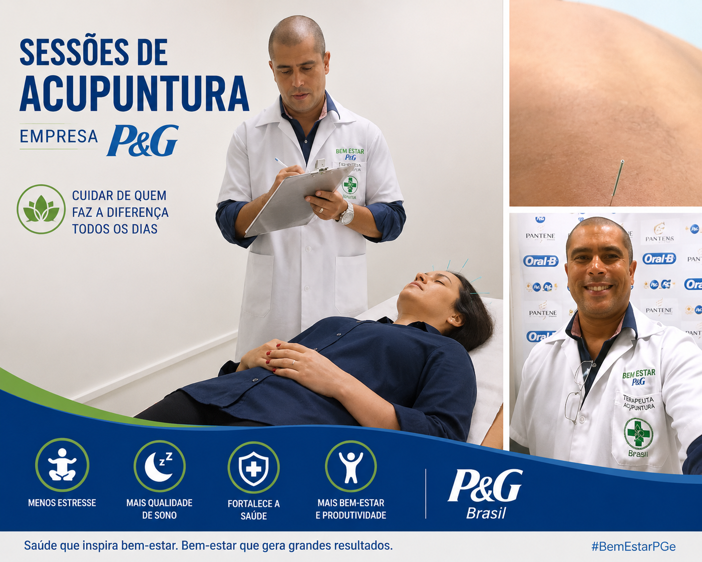 Acupuntura corporativa Procter & Gamble Brasil — bem-estar no trabalho RJ